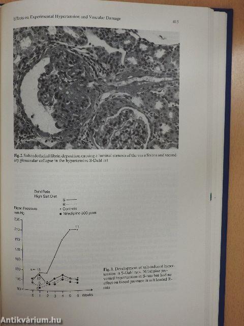 Cardiovascular Effects of Dihydropyridine-Type Calcium Antagonists and Agonists