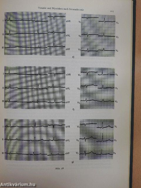 Atlas der klinischen Elektrokardiographie