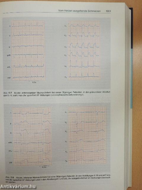 Differentialdiagnose innerer Krankheiten