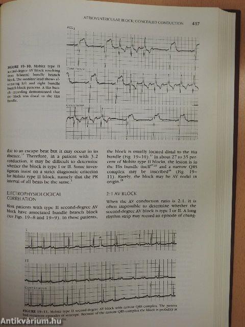 Electrocardiography in Clinical Practice