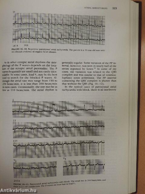 Electrocardiography in Clinical Practice