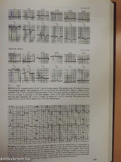 Electrocardiography in Clinical Practice