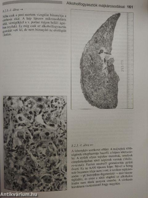 Májpatológia klinikusoknak