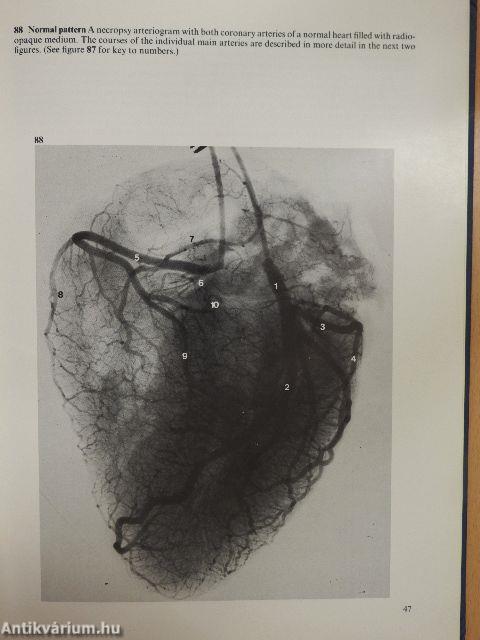 A Colour Atlas of Cardiac Pathology