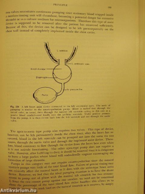 Artificial heart