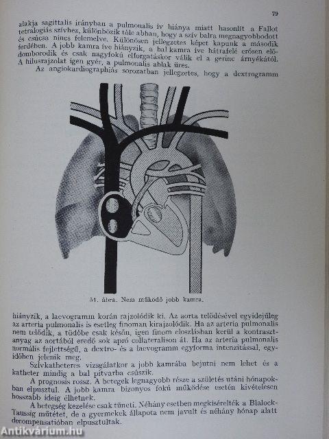 A szív és a nagyerek veleszületett fejlődési rendellenességei