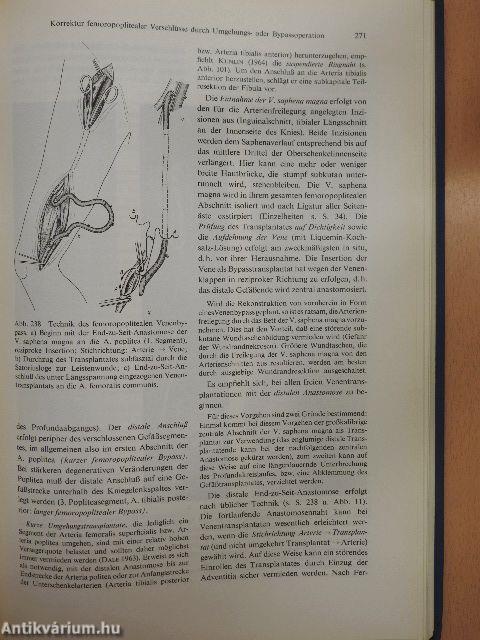 Rekonstruktive Chirurgie der Arterien