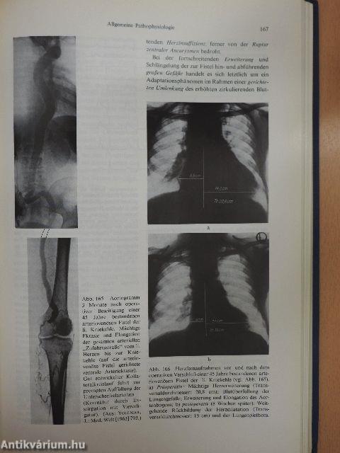 Rekonstruktive Chirurgie der Arterien