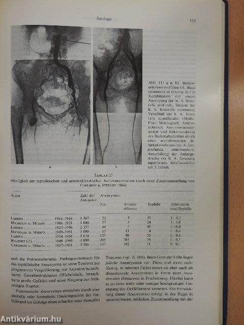 Rekonstruktive Chirurgie der Arterien