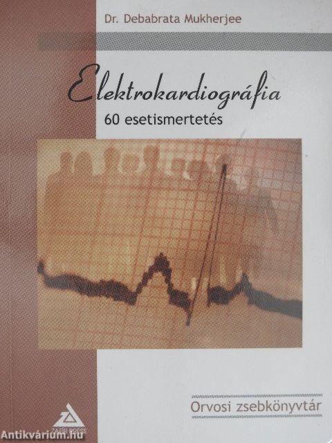 Elektrokardiográfia - 60 esetismertetés