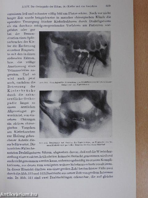 Leitfaden der Chirurgie und Orthopädie des Mundes und der Kiefer