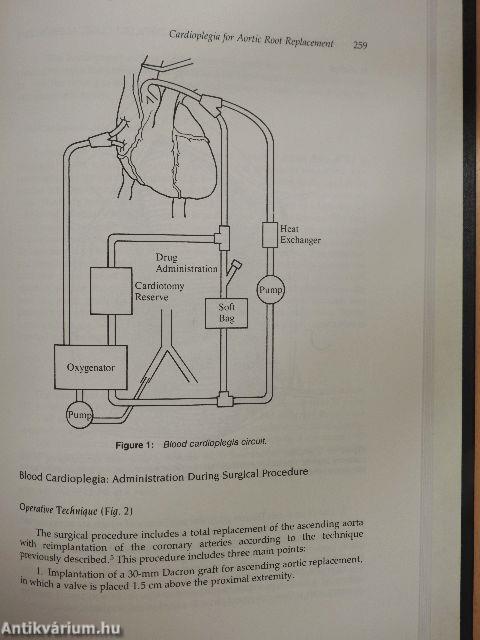 A Textbook of Cardioplegia for Difficult Clinical Problems