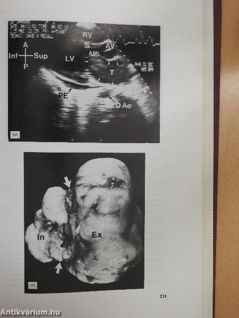 The Practice of Echocardiography