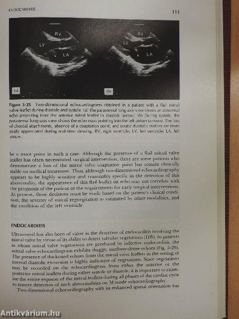 The Practice of Echocardiography