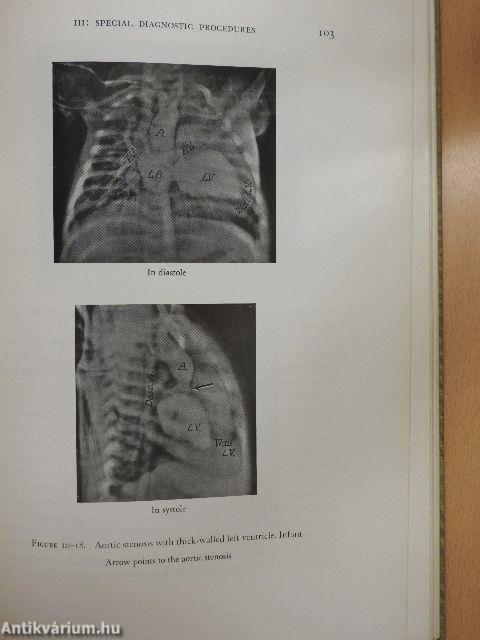 Congenital Malformations of the Heart I.