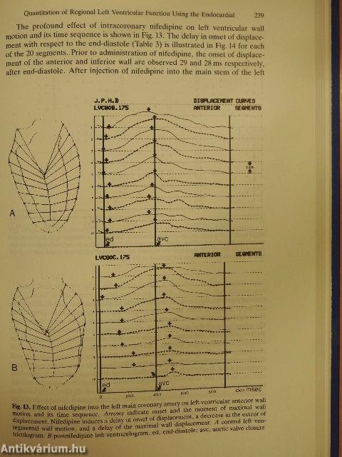 Angiocardiography