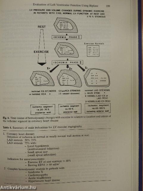 Angiocardiography