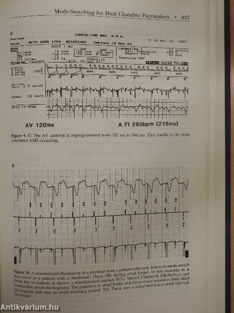 Nonpharmacological Therapy of Arrhythmias for the 21st Century