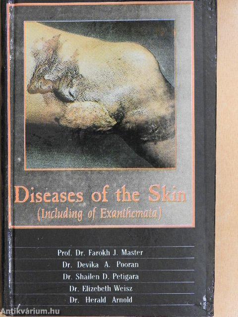 Diseases of the Skin Including the Exanthemata