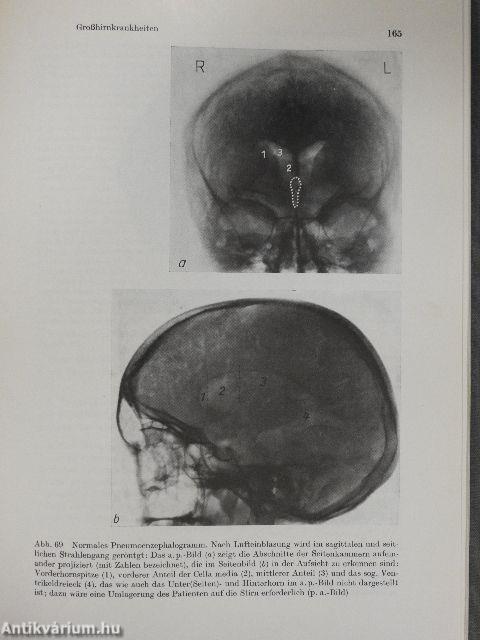 Neurologie und Psychiatrie sowie Grundzüge der Kinderneuropsychiatrie