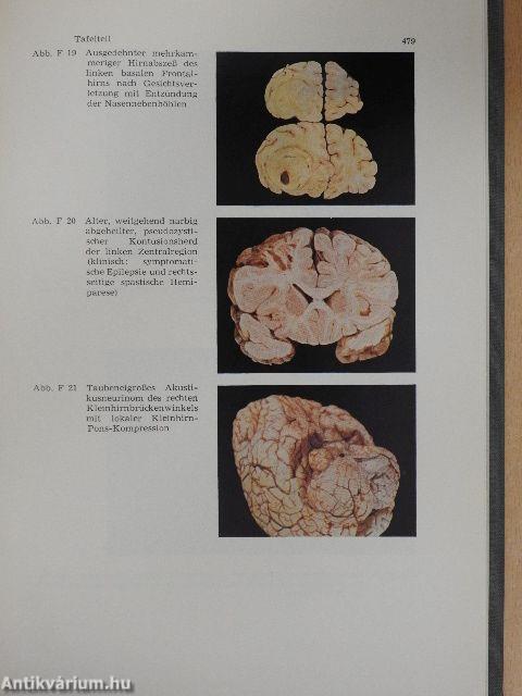 Neurologie und Psychiatrie sowie Grundzüge der Kinderneuropsychiatrie