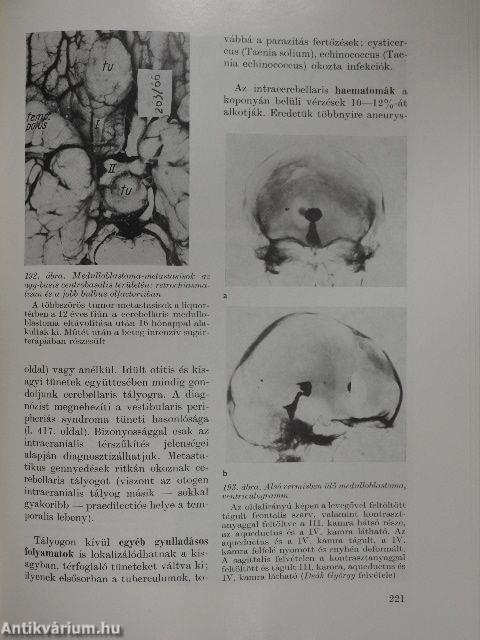 A klinikai neurológia alapjai