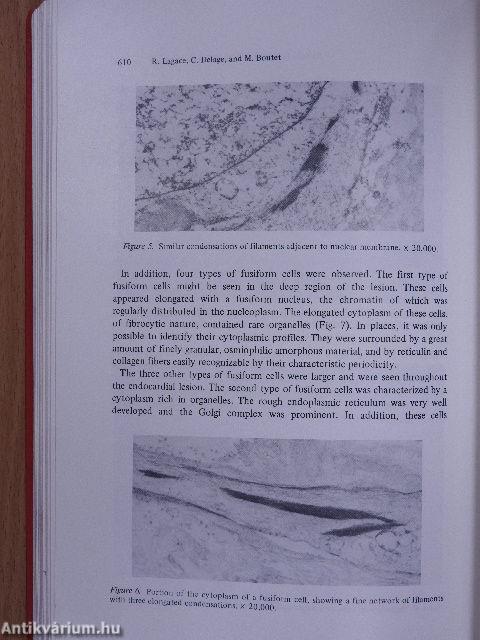 The Metabolism of Contraction (dedikált példány)