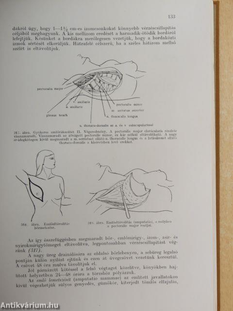 Sebészeti műtéttan