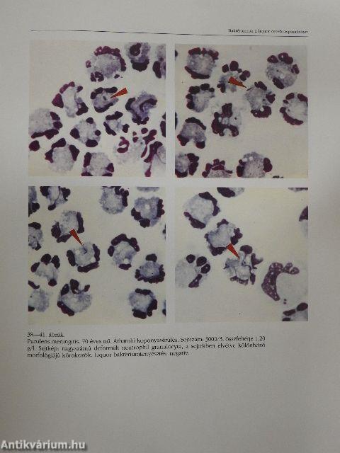 Liquor citodiagnosztika a klinikai gyakorlatban