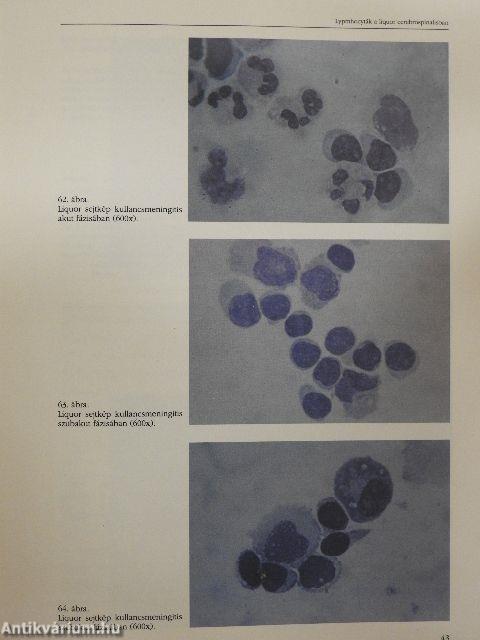 Liquor citodiagnosztika a klinikai gyakorlatban