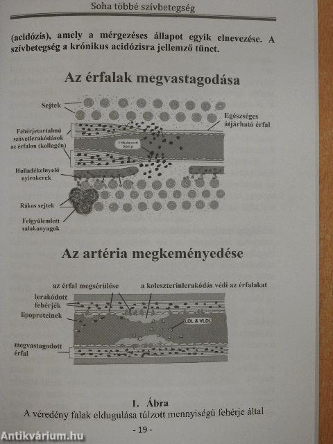 Soha többé szívbetegség!