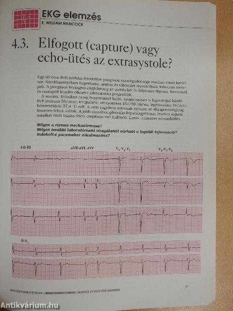 EKG esetismertetések