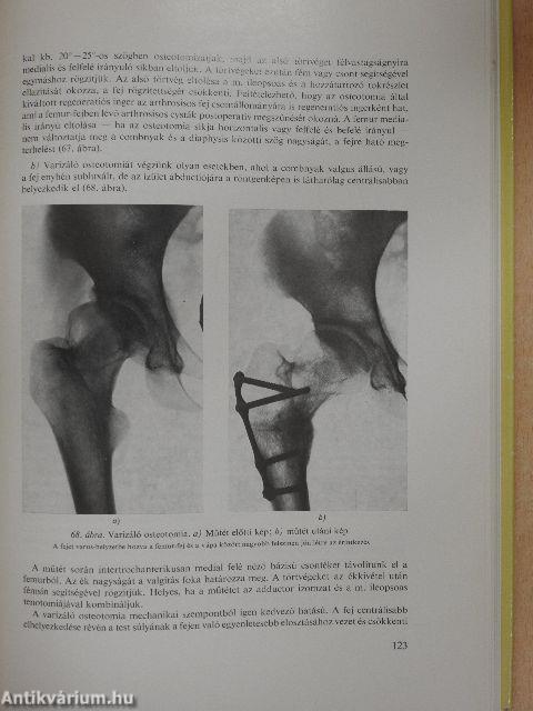 Az orthopaedia tankönyve