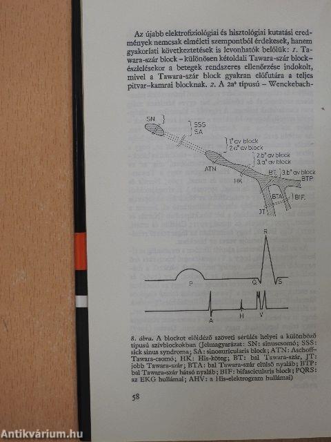 Pacemaker terápia