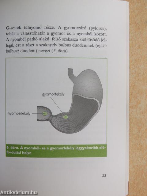 A fekélybetegség és a Helicobacter pylori-fertőzöttség