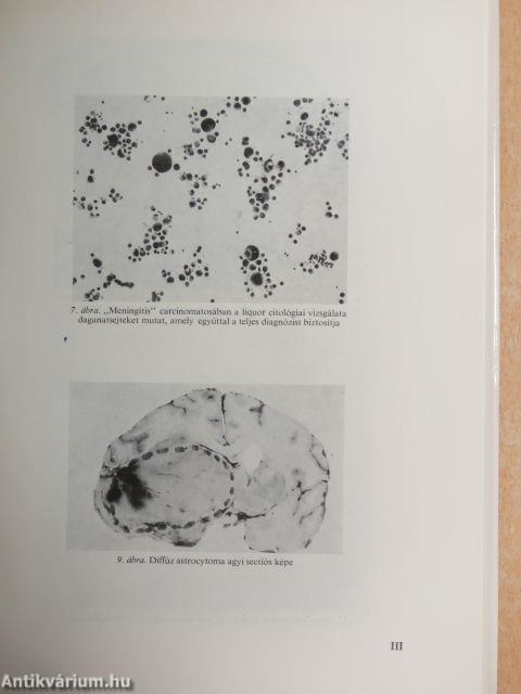 Idegsebészeti alapismeretek