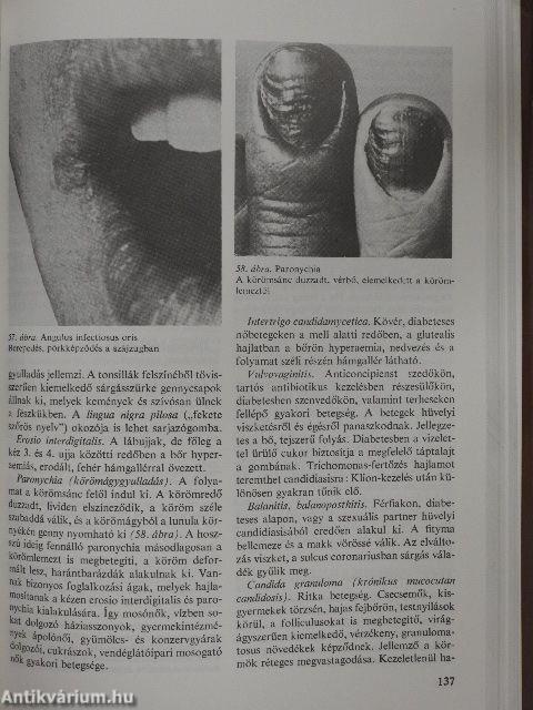 Bőr- és nemi betegségek