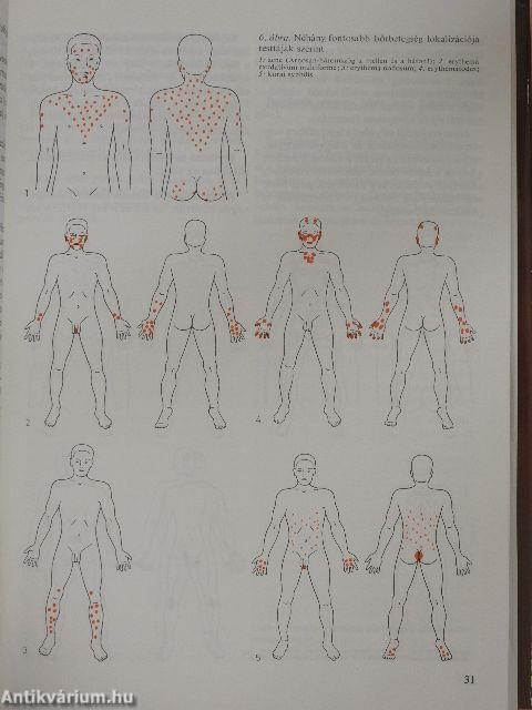 Bőr- és nemi betegségek