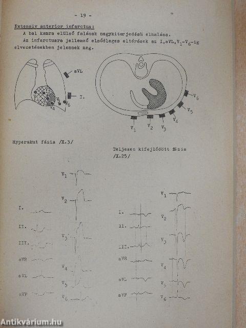 EKG alapismeretek