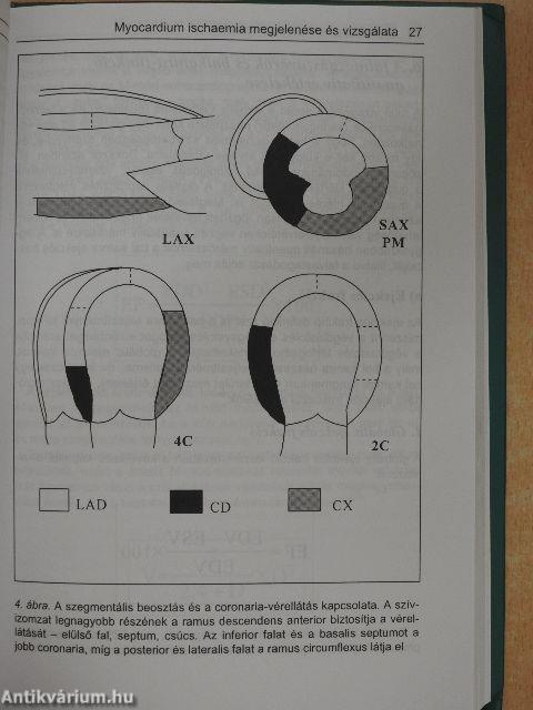 Terheléses echocardiographia