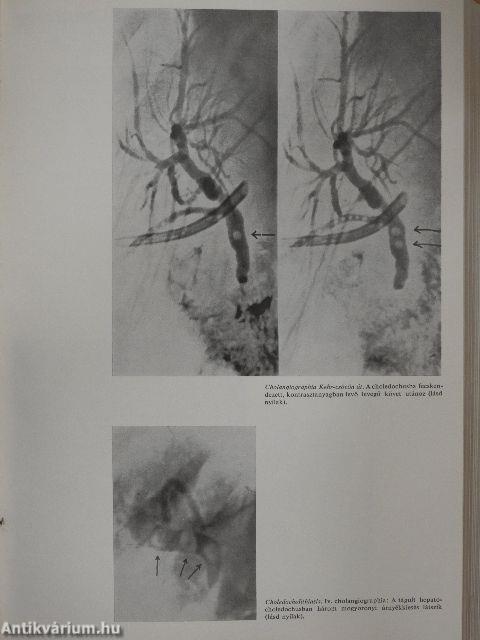 Orvosi lexikon 1-4.