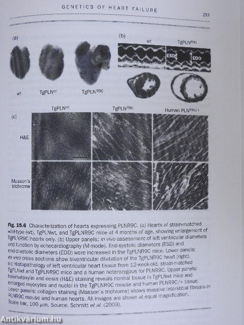 The Year in Heart Failure I.