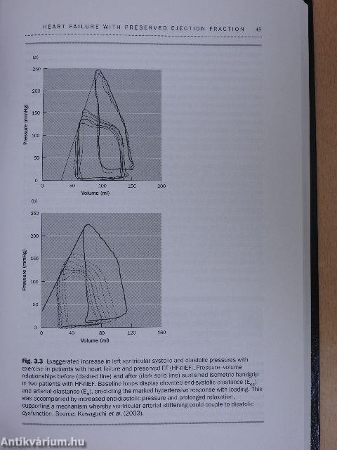 The Year in Heart Failure I.