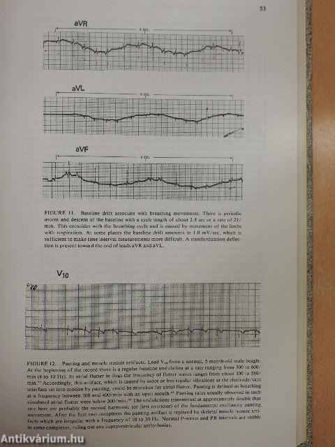 Cardiac Toxicology III