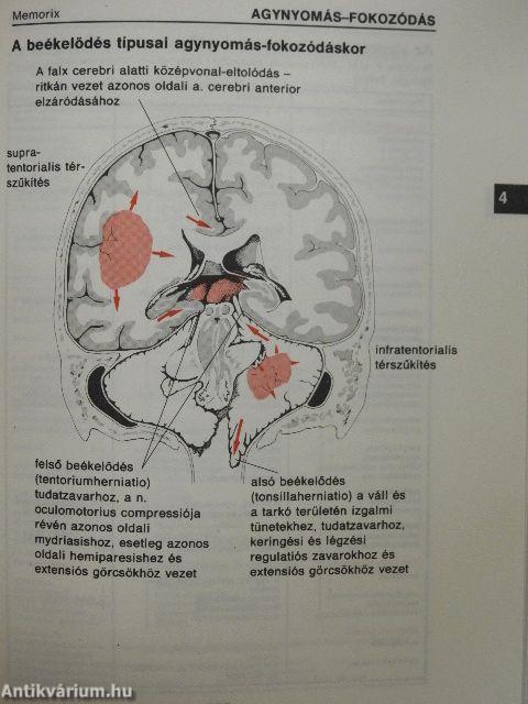 Neurológia