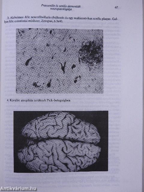 Válogatott fejezetek a gerontopszichiátriából