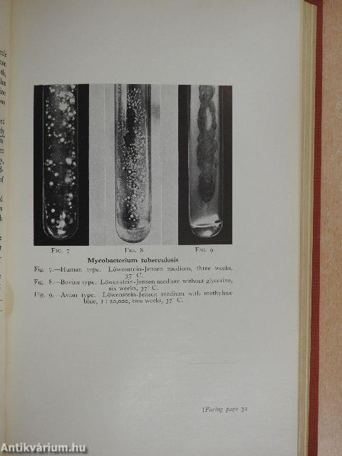 Tubercle Bacillus and Laboratory Methods in Tuberculosis