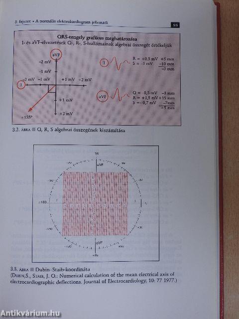 EKG a gyermekkorban