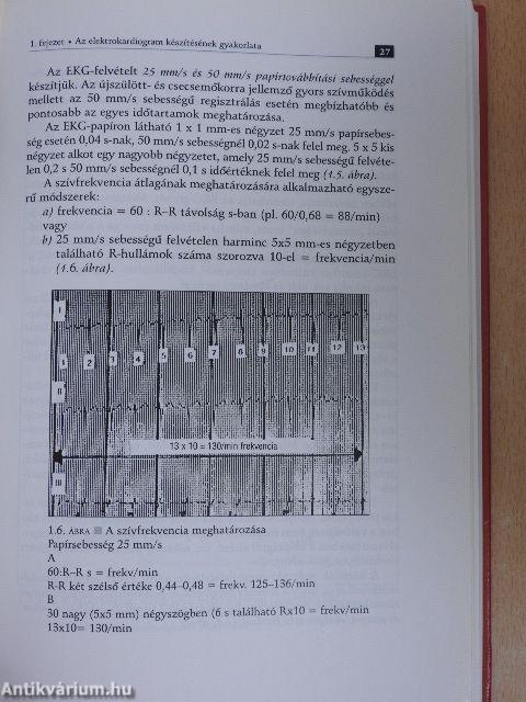 EKG a gyermekkorban