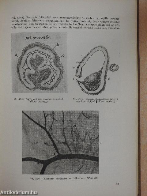 A primaer glaukoma